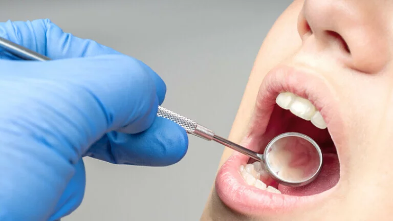 Revolucioni në stomatologji – Gel që rigjeneron zmaltin e dhëmbit