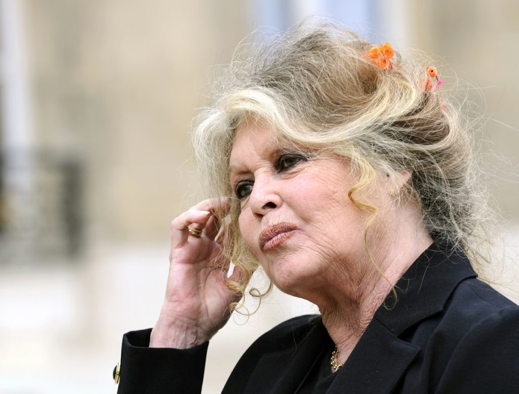 Brigitte Bardot qetëson publikun pas ndërhyrjes kirurgjikale