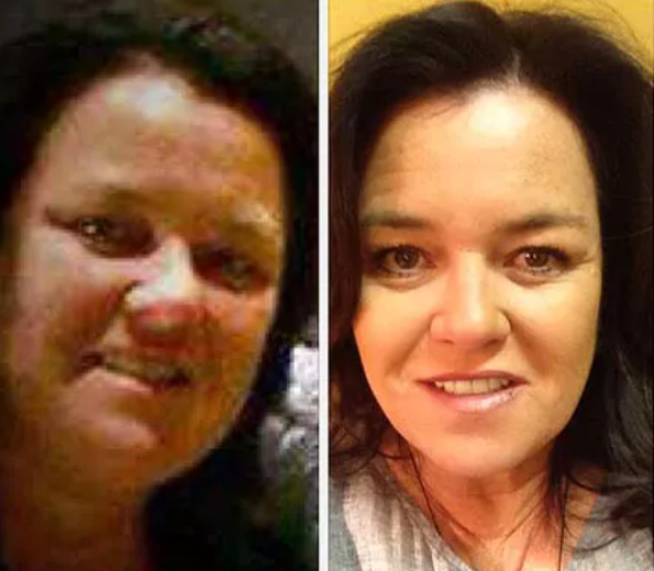 Rosie O’Donnell zbulon liftingun sekret të fytyrës: “Kam paguar sa për një veturë”